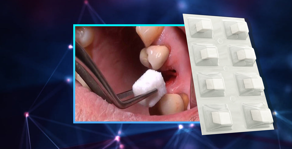 The Key to Preventing Postoperative Complications- DSI Hemostatic Sponge