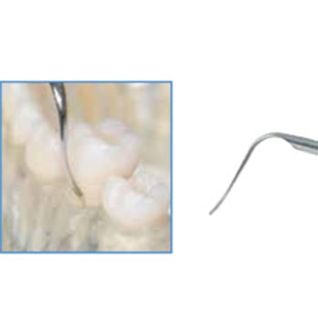 Biosonic Piezo Tips - Scaling