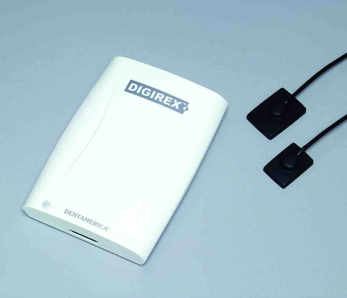 Digirex Digital Dental Radiography System (With Sensor Size #1)