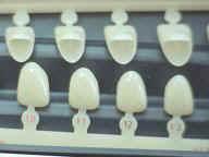 Ion Polycarbonate Crowns - Upper Right Centrals (5)
