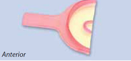 Neo Trays - Anterior 30/Bx