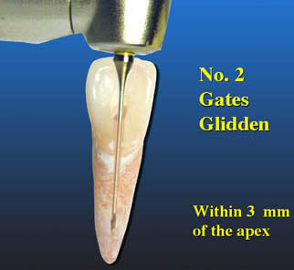 Essential Gates Gliden Drill Refills - Pack of 5
