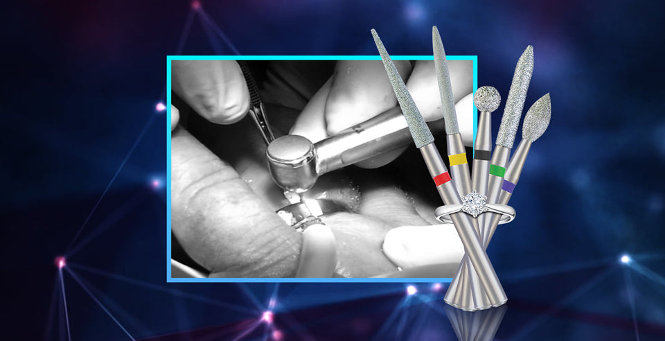 DSI Diamond Dental Bur- Removing Old Fillings and Polishing Hard Tissues