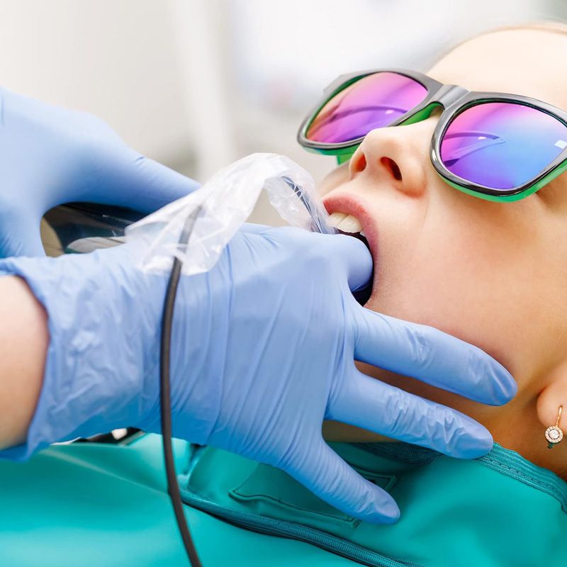 Disposable Sleeves for X-Ray Digital Sensors