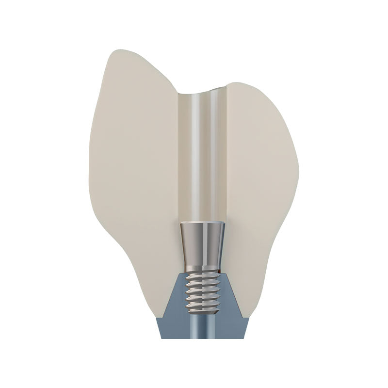 DSI EvoConnect - Direct Сonnection Screws for Multi-Unit Abutments M1.7