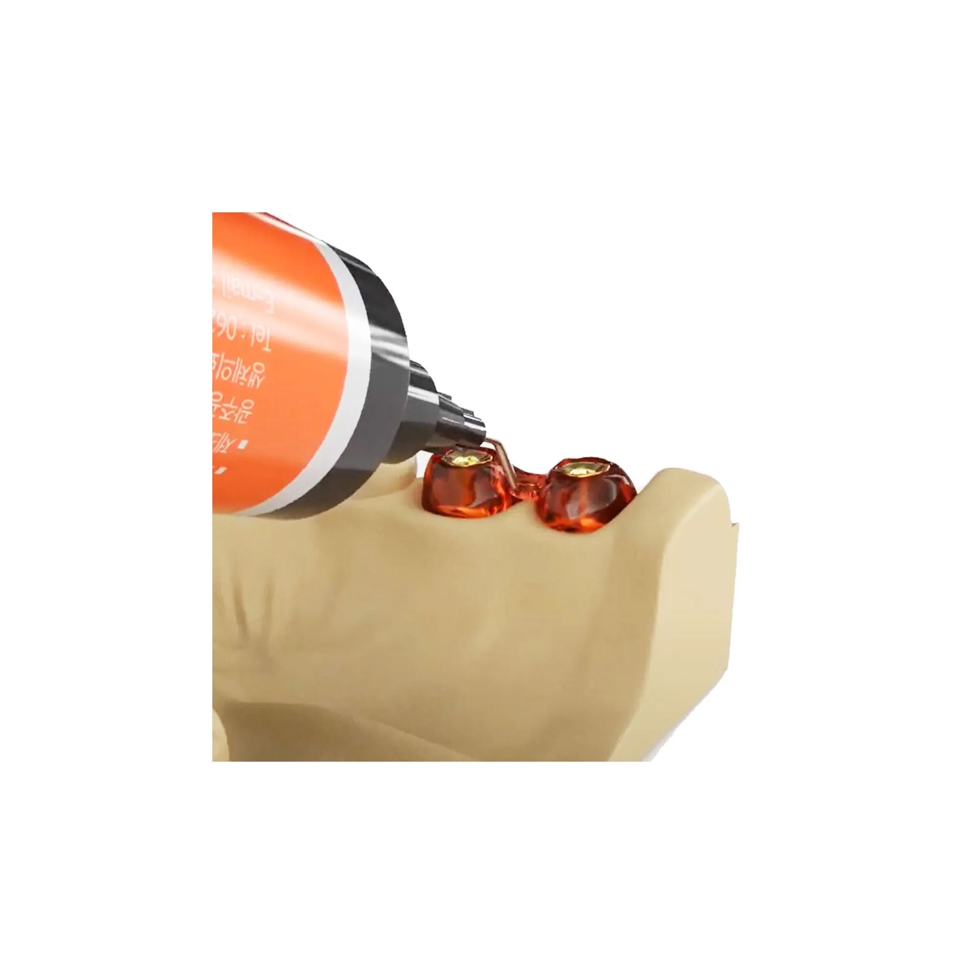 MEDICLUS LC Pattern Resin In Syringe 14g