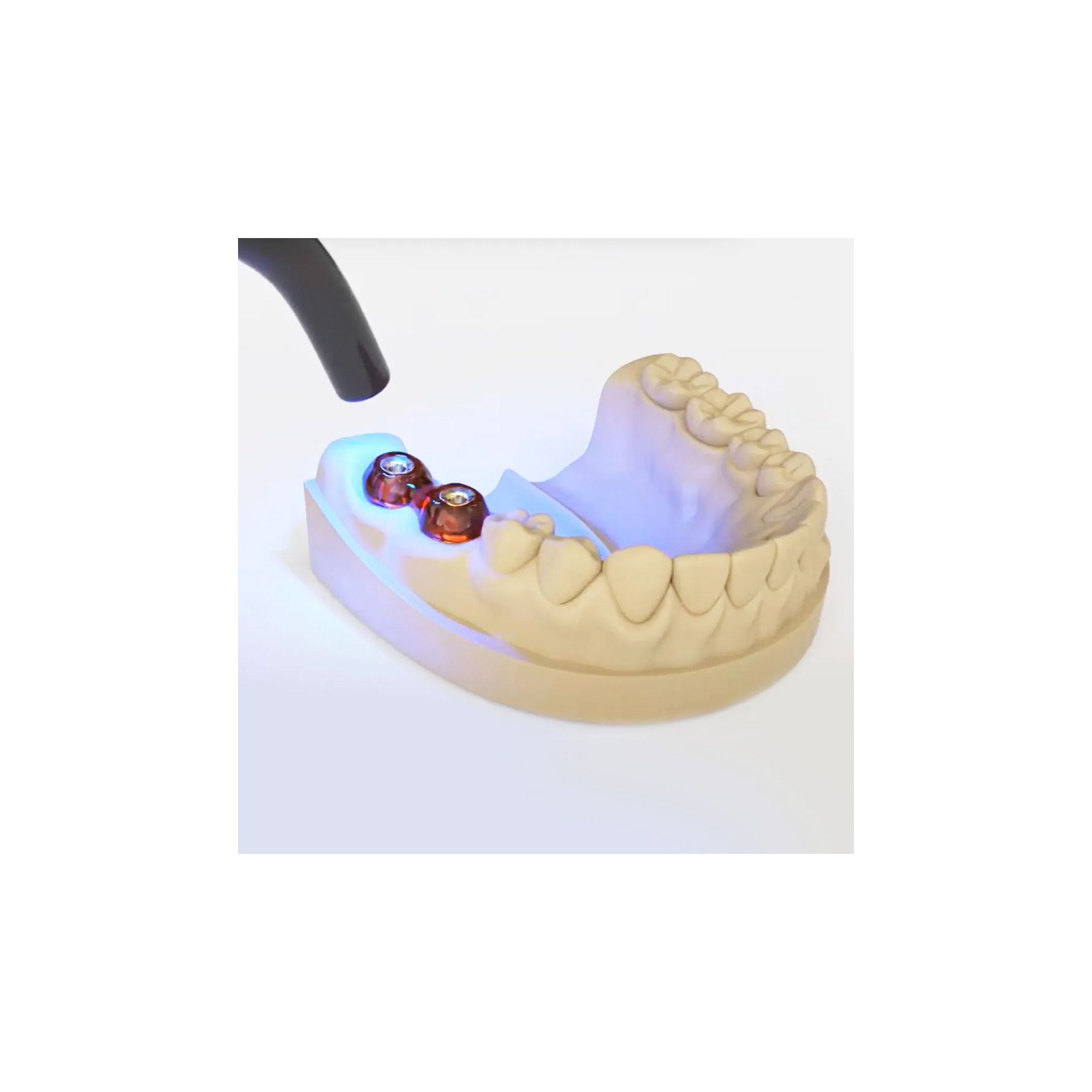 MEDICLUS LC Pattern Resin In Syringe 14g