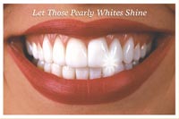 Recall Card - Pearly Whites Laser 4-Up (200)