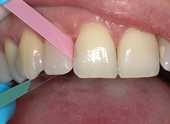 Super Snap Polystrips Finishing & Polishing Strips