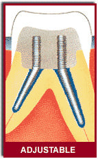 Filpost Standard Package