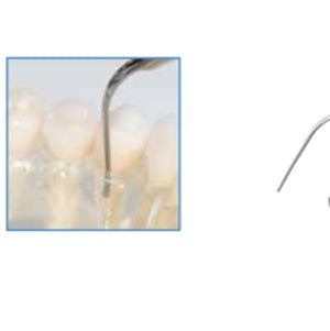 Biosonic Piezo Tips - Scaling